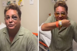 Leonardo vai ao hospital após acidente em canoa e tranquiliza fãs