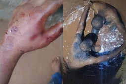 Vizinho tenta salvar mulher esfaqueada e cai em cisterna durante luta com agressor em Rio Verde