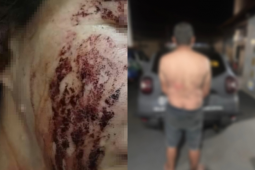 Em pânico e com sangue no rosto, mulher corre para pedir socorro à GCM