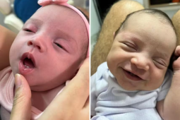 Bebê nasce com dois dentes e surpreende família em Rio Verde