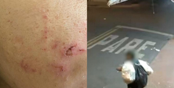 Morador de rua é preso pela Polícia Civil após tentativa de estupro com violência no Morada do Sol