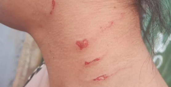 Confusão familiar em bar termina em agressões e ameaça contra bebê de 4 meses em Santo Antônio da Barra