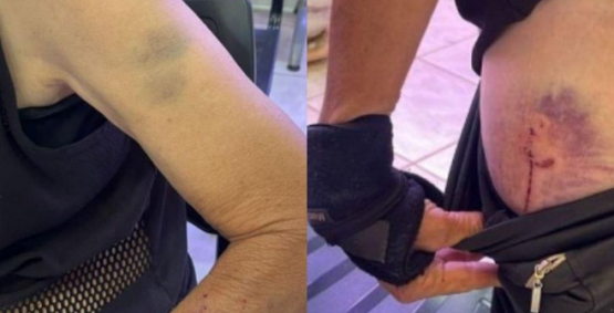 Homem é preso por espancar e estuprar companheira após ela negar relação sexual em Rio Verde