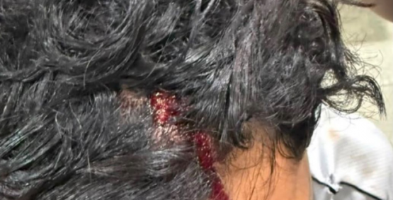 Mulher é presa suspeita de invadir casa e agredir ex-namorado após fim do relacionamento em Rio Verde