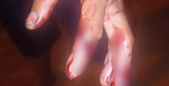 PM prende suspeito após ataque a casal, incluindo gestante, no bairro Martins, em Rio Verde