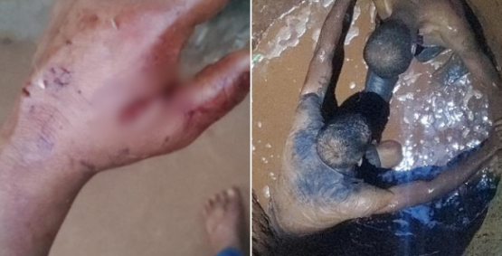 Vizinho tenta salvar mulher esfaqueada e cai em cisterna durante luta com agressor em Rio Verde