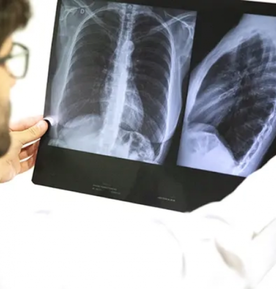 Goiás decreta emergência em saúde após alta de casos de síndrome respiratória grave