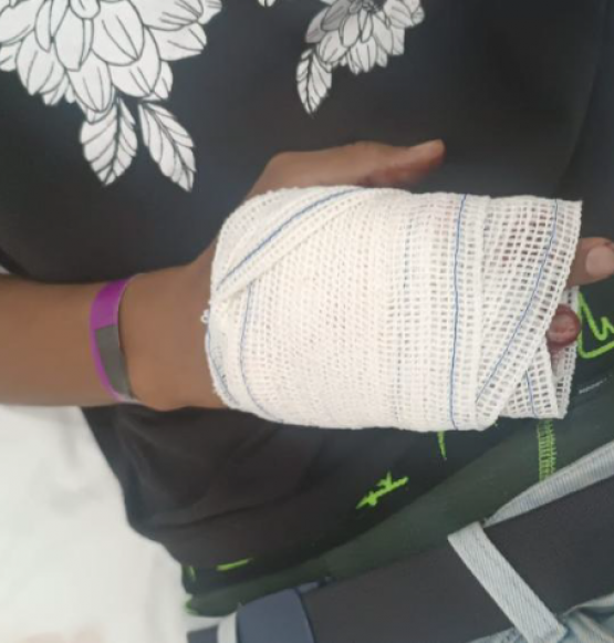 Homem é baleado na mão após desentendimento durante a madrugada na Vila Santa Cruz, em Rio Verde