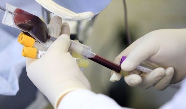 Anvisa recomenda que infectados por varíola dos macacos aguardem 21 dias para doar sangue