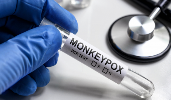 ANS determina que planos de saúde cubram teste para varíola dos macacos