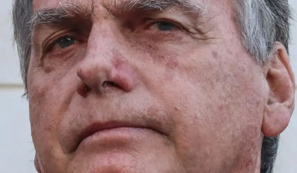 Bolsonaro é internado em Brasília para cirurgia de hérnia nesta quinta (25)