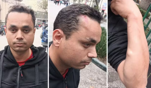 Rio-verdense é agredido no seu primeiro dia de trabalho em restaurante no Chile