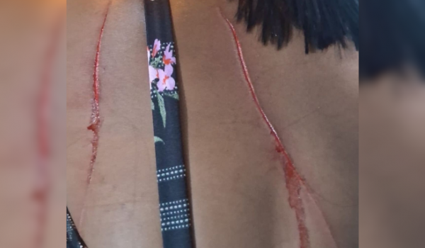 Confusão generalizada termina com vítima com corte nas costas no bairro Maranata, em Rio Verde