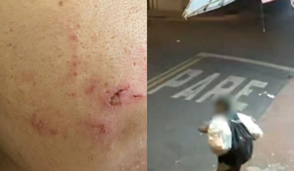 Morador de rua é preso pela Polícia Civil após tentativa de estupro com violência no Morada do Sol