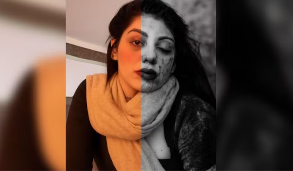 Mulher expõe agressões do lutador Godofredo Pepey em post nas redes