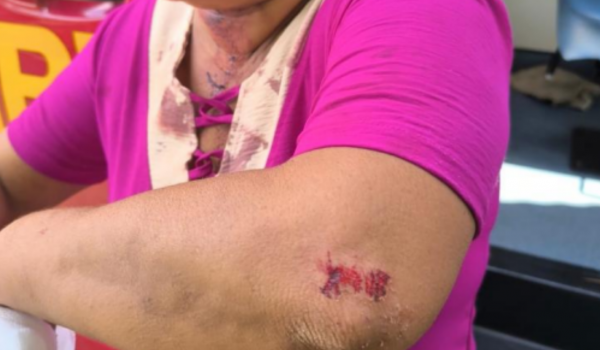 Homem agride mãe e tenta matar padrasto a facadas no Gameleira II