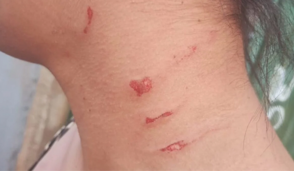 Confusão familiar em bar termina em agressões e ameaça contra bebê de 4 meses em Santo Antônio da Barra