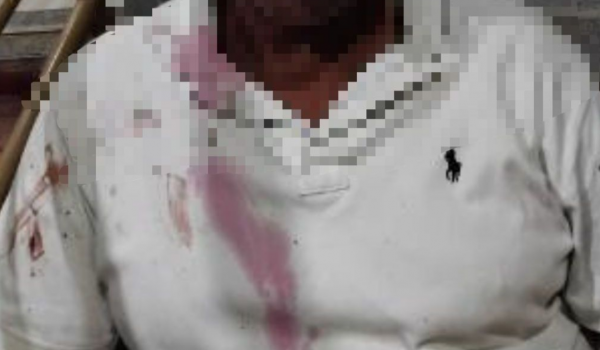 Discussão por celular em festa termina em agressão e atuação da GCM no Portal dos Ipês