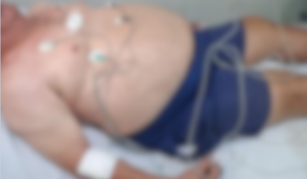 Homem é atacado com arma branca dentro de bar na Vila Santa Cruz, em Rio Verde