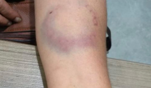 Homem é preso após agredir companheira com tapas, chutes e mordida em Rio Verde