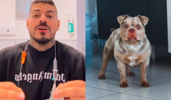Influenciador descobre que perdeu dedo do pé após cachorro comer enquanto ele dormia