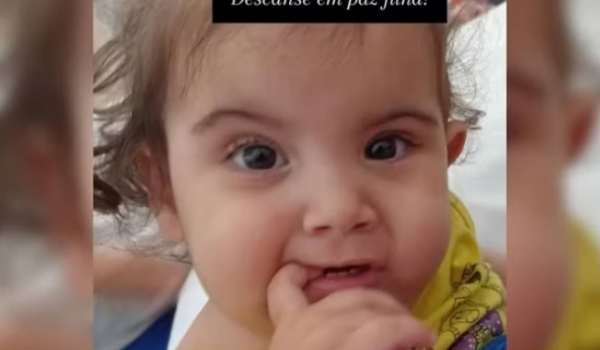 Kiraz, uma das gêmeas siamesas separadas em cirurgia inédita morre, em Goiânia