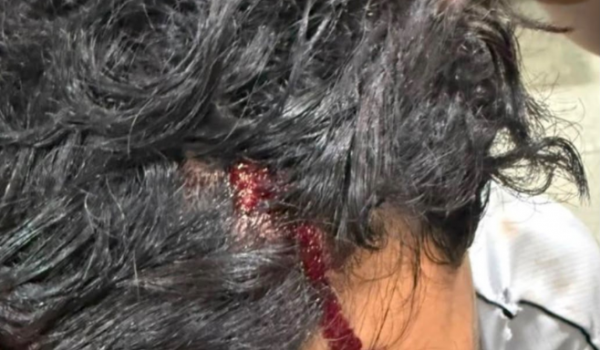 Mulher é presa suspeita de invadir casa e agredir ex-namorado após fim do relacionamento em Rio Verde