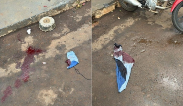 Pedestre é atacado por cães da raça pitbull no Conjunto Valdeci Pires