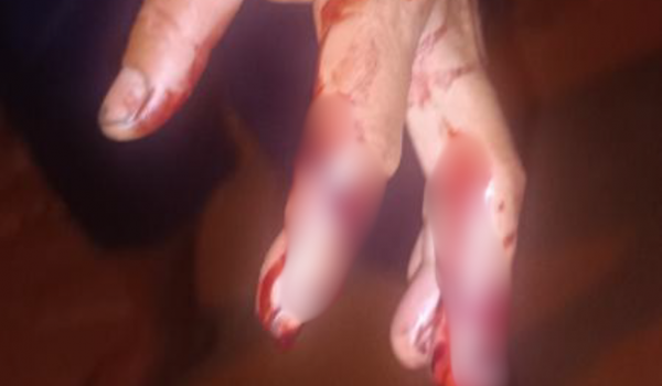 PM prende suspeito após ataque a casal, incluindo gestante, no bairro Martins, em Rio Verde