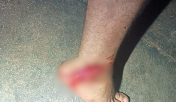 Polícia Militar flagra furto em comércio de futevôlei no setor Morada do Sol