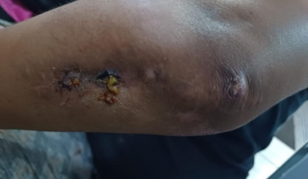 Polícia Militar atua com rapidez em caso de agressão no bairro Popular
