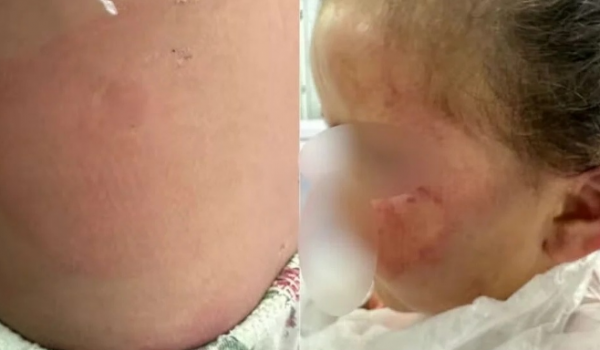  Mulher é presa em Goiás após filha ser agredida até desmaiar