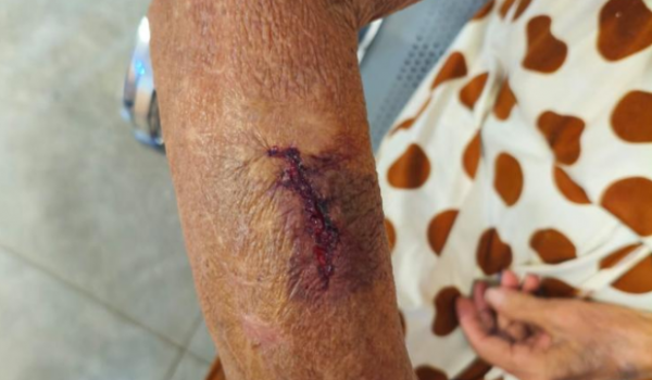 PM prende mulher após agredir filhos e ferir a própria avó, de 90 anos, com faca no Setor Pauzanes