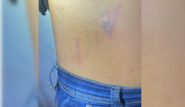 Mulher foge após ser estuprada e agredida; polícia prende suspeito em Rio Verde