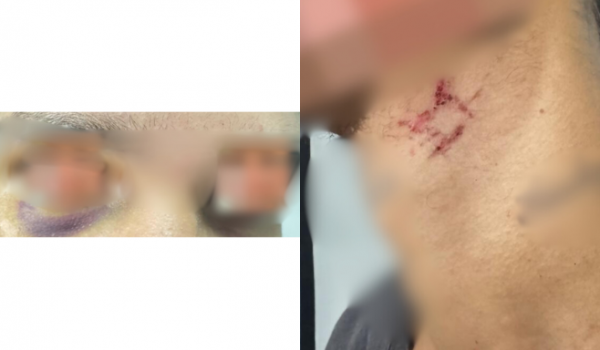 Polícia Civil resgata homem mantido como escravo sexual e desarticula esquema de tráfico internacional em Goiânia