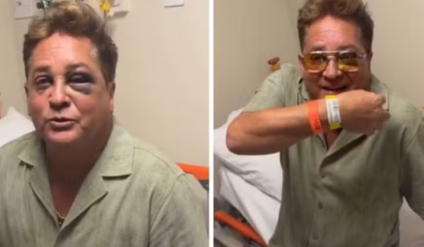 Leonardo vai ao hospital após acidente em canoa e tranquiliza fãs