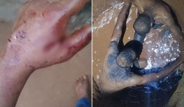 Vizinho tenta salvar mulher esfaqueada e cai em cisterna durante luta com agressor em Rio Verde