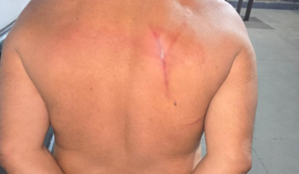 Ao tentar agredir a própria filha, homem é contido e acaba ferido na zona rural de Rio Verde