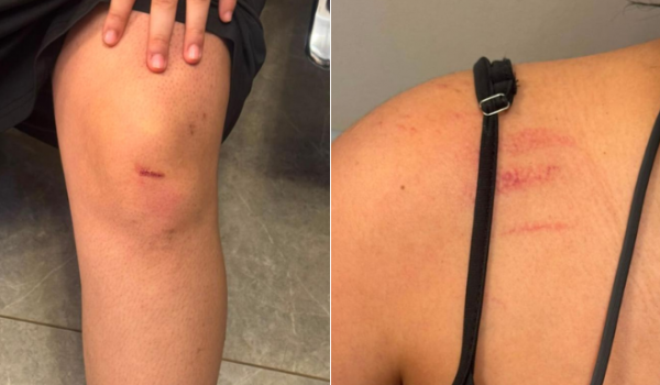 Homem é preso após agredir irmã grávida de 37 semanas em Rio Verde