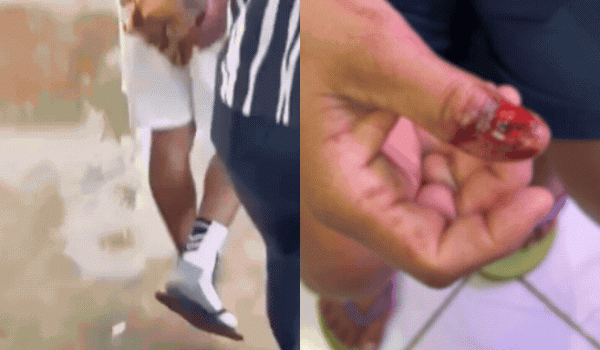 Homem é preso após morder e arrancar unha da companheira durante ataque em Rio Verde