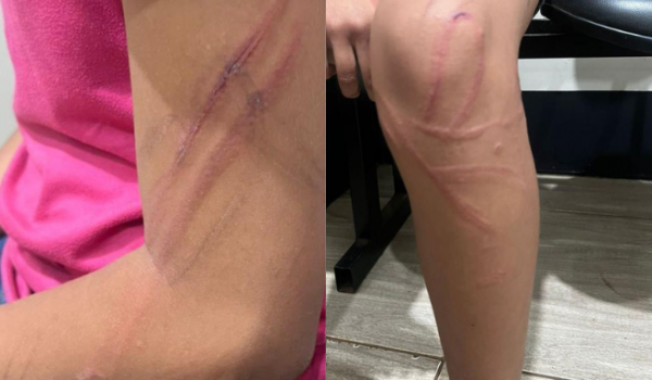 Venezuelano é preso por agredir irmã menor com pedaço de fio na Vila Rosalina, em Rio Verde