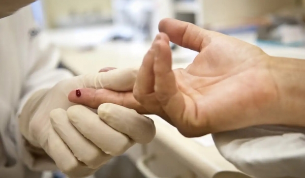 Dia Internacional contra a Aids: ciência já testa vacina contra HIV