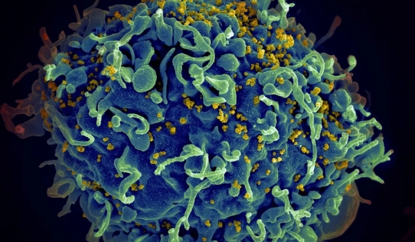 Cientistas anunciam 7º paciente curado do HIV