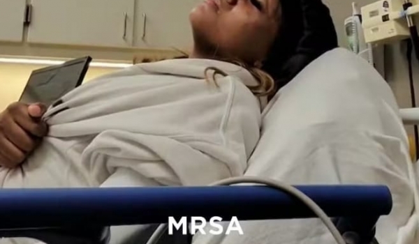 Jovens contraem superbactéria após mergulho em piscina de hotel