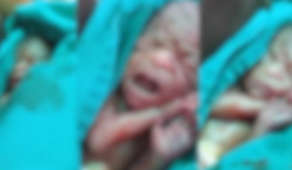 Esperança interrompida: bebê prematuro dado como morto volta a respirar, mas não sobrevive