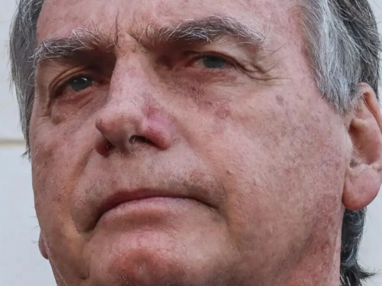 Bolsonaro é internado em Brasília para cirurgia de hérnia nesta quinta (25)