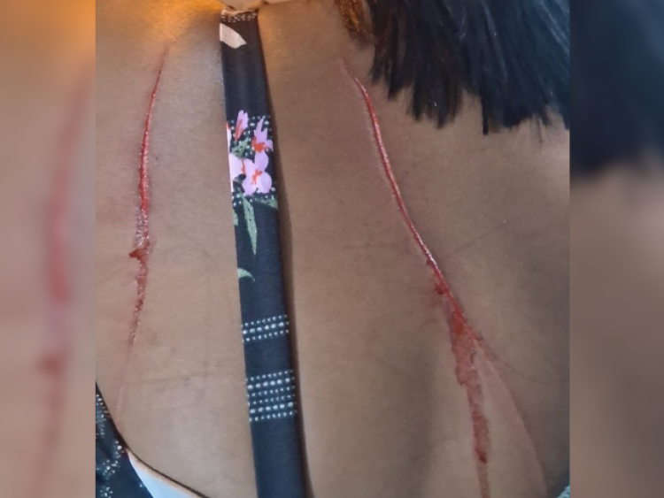 Confusão generalizada termina com vítima com corte nas costas no bairro Maranata, em Rio Verde