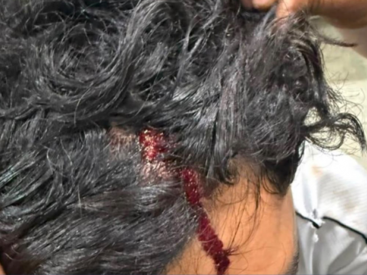 Mulher é presa suspeita de invadir casa e agredir ex-namorado após fim do relacionamento em Rio Verde