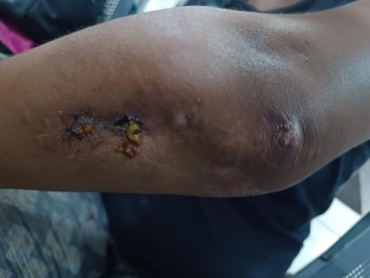 Polícia Militar atua com rapidez em caso de agressão no bairro Popular