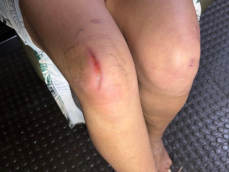 Mantida em cárcere privado, mulher se joga de moto em movimento para fugir do companheiro no Residencial Canaã